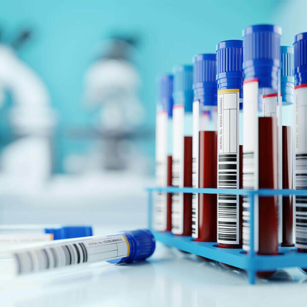 Titer-Test-Blood-Test-FAVN FAVN Blood Test Tubes