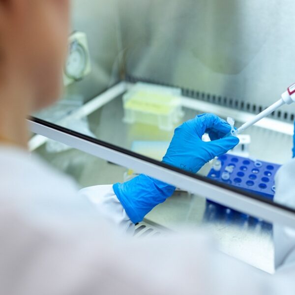 xet-nghiem-khang-the-dai-rabies-test xet nghiem khang the dai rabies test